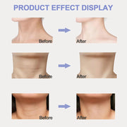 Neck cream results
